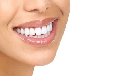 $33 for Dental Exam, X-Ray, & $1,500 Toward Implant or Fixed Bridge at Novel Smiles (Up to $1,800 Value)  