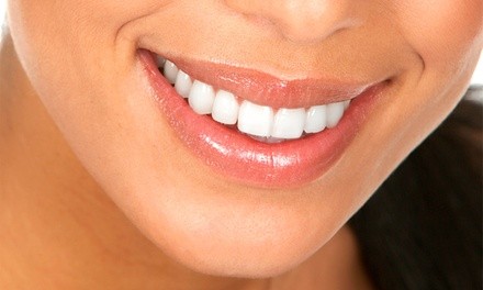 $3,430 for a Permanent Lip Augmentation at Beverly Hills Institute of Plastic Surgery ($5,900 Value)
