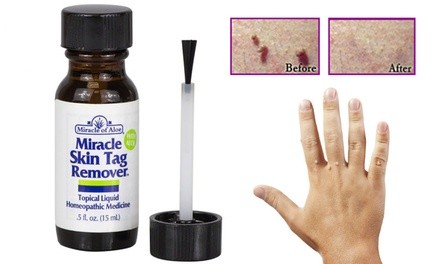 Miracle Skin Tag Remover With Aloe (1-, 2-, or 3-Pack)