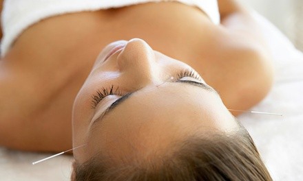 $41.50 for an Acupuncture Treatment at AcuSpa Wellness Center & Spa (Up to $145 Value)