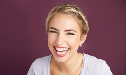 Up to 76% Off on Teeth Whitening - In-Office - Non-Branded at Modern White Smile