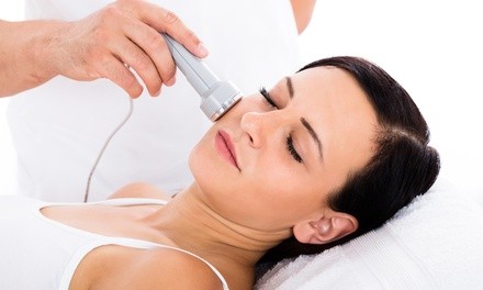 One or Two IPL Photofacials at SoCal Lazer & Medi-Spa (Up to 50% Off)