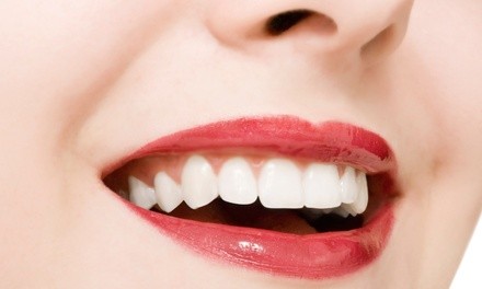 Dental Exam, Cleaning, Two X-Rays, and Optional Take-Home Whitening Kit at Dr. Warren Richman (Up to 85% Off)
