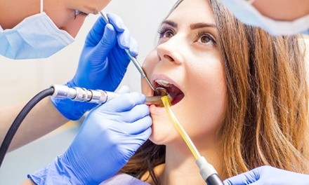 Up to 50% Off on Dental Filling at Todays Dental @ Lexington