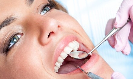 Up to 50% Off on Dental Checkup (Cleaning, X-Ray, Exam) at Todays Dental @ Greenville