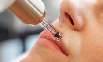 Up to 30% Off on Mesotherapy - Needleless at She Arted llc