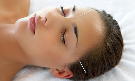 Up to 50% Off on Acupuncture Services at Charlestin Chiropractic