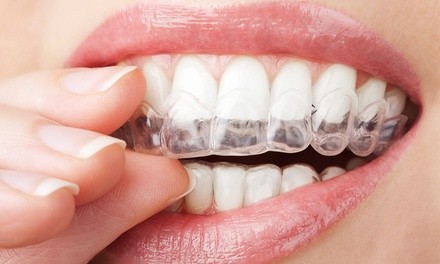 $2,899 for an Invisalign or Fastbraces Orthodontic Treatment at Dental Associates of Lodi ($6,000 Value)