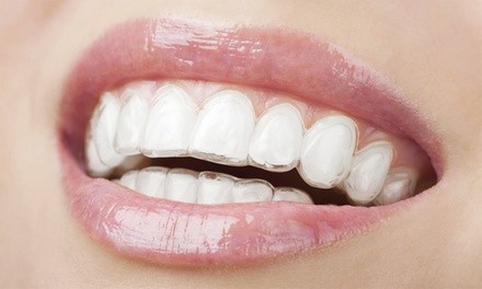 Invisalign Package with Optional Teeth Whitening Session at Metropolitan Dental Associates (Up to 53% Off)