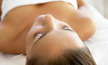 Up to 38% Off on Acupuncture Services at Restore