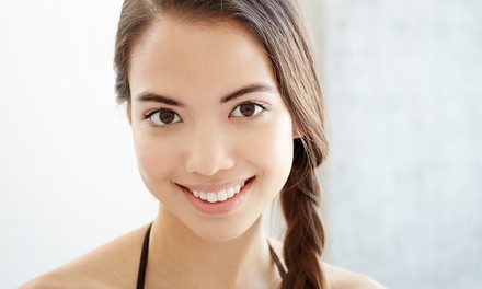 Up to 40% Off on Acne Treatment (Service) at Lilly G Esthetics