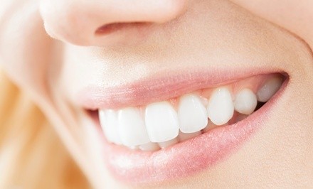 Up to 68% Off on Teeth Whitening - Traditional at Celebrity White