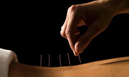 Up to 80% Off at Santa Clara acupuncture