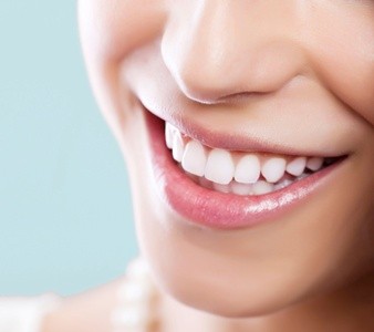 Up to 50% Off on Teeth Whitening - In-Office - Non-Branded at Face It! You're Beautiful!
