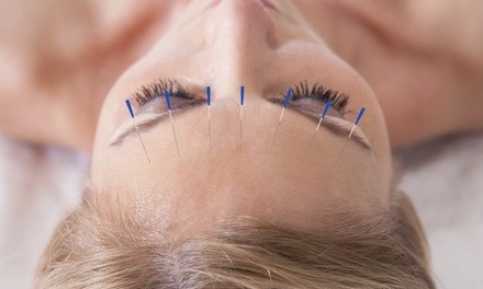 Up to 43% Off on Acupuncture Services at Transformational Acupuncture