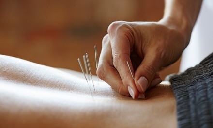 Up to 59% Off on Acupuncture Services at Optimum Vitality