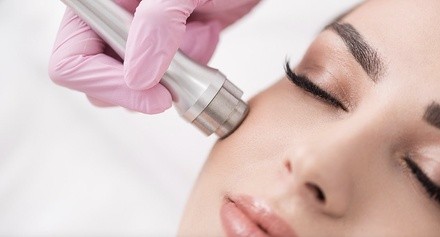 Up to 38% Off on Microdermabrasion at Skin Radiance medspa