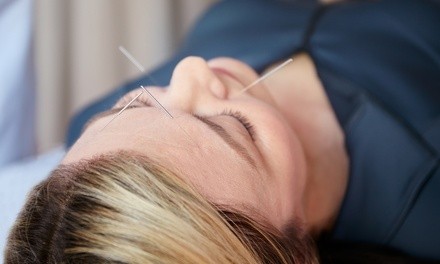 One or Three Acupuncture Sessions with Optional Motion Study X-ray at Pennridge Wellness Center (Up to 82% Off) 