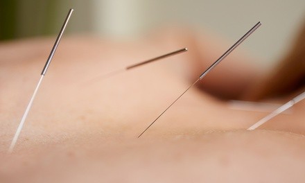 One or Three Acupuncture Sessions, or an Acupuncture Session and Massage at Denver Acu Pro (Up to $ Off) 