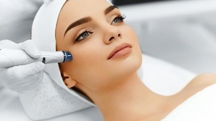 Up to 50% Off on Micro-Needling at Essential Skin Care at Vogue 57 Salon