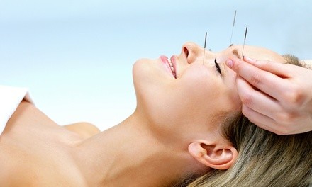 Acupuncture Treatments at Healing Tree Acupuncture & Wellness Center (Up to 60% Off). Three Options Available. 