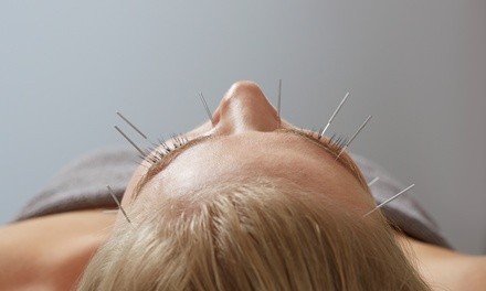 One or Two Acupuncture Treatments w/ Cupping and Consultation at Abundant Blessing Acupuncture (Up to 58% Off) 