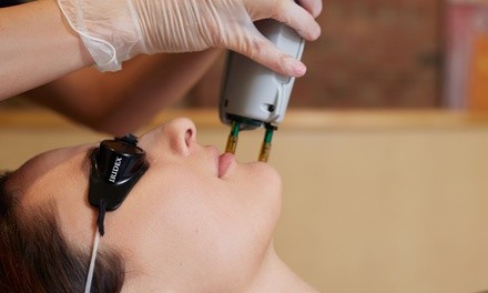 Up to 64% Off on IPL Photo Facial at Paris Lanae Makeup & Bar