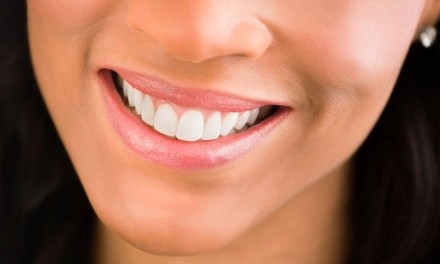 $75 for Dental Cleaning with Exam and X-Rays at Bloom Dental ($335 Value)