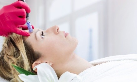 Up to 70% Off on Micro-Needling at Regrow Medspa