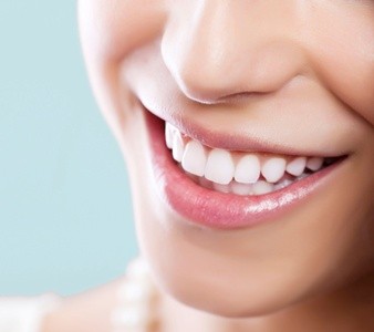 Up to 88% Off on Teeth Whitening - Traditional at Alexa Mar Wellness Retreat