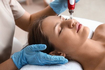 Up to 50% Off on Micro-Needling at Bella Spa and Skin Care