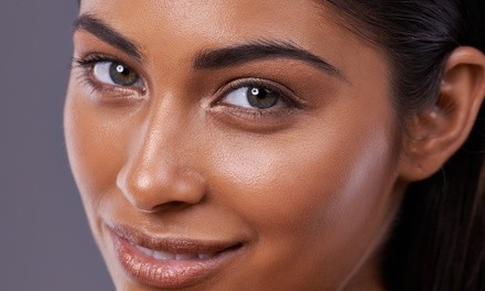 One or Two Microneedling Treatments with Peels at SHA Skincare & Healing Coaching (Up to 50% Off)