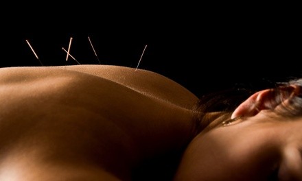 Consultation and One or Two Acupuncture Sessions and Cupping Session at Good Needles Acupuncture (Up to 38% Off)