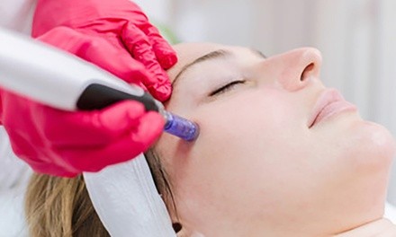 Microneedling for Face, Face and Neck, or Face, Neck, and Chest at Alabama Women's Healthcare (Up to 50% Off)