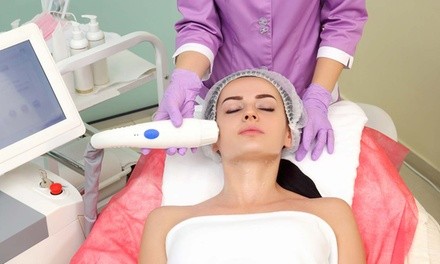 One, Two, or Three IPL Photofacials at Laser Fit (Up to 88% Off). Four Options Available.