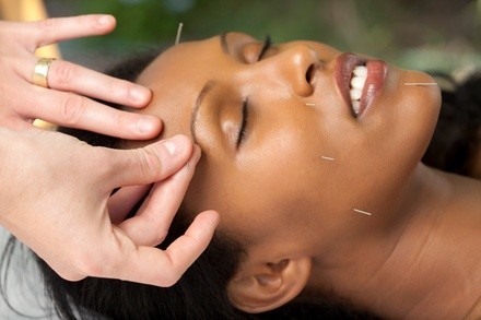 Up to 80% Off on Acupuncture Services at BARUCH MEDICAL