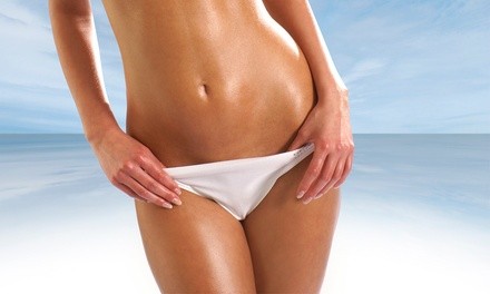 One, Two, or Four i-Lipo Body-Contouring Treatments at  Vitality Med Spa and Plastic Surgery Center (Up to 73% Off) 