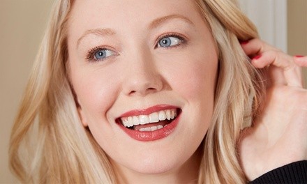 $75 for One 60-Minute In-Office Teeth Whitening Treatment at BodyBrite ($129 Value)