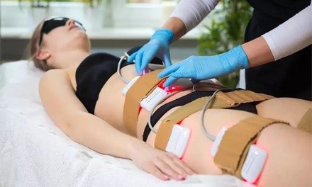 Up to 64% Off on Liposuction - Non-Invasive Laser (iLipo) at Black Cat Aesthetics