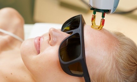 One or Three IPL Photo Facials at Wellness Medical and Spa (Up to 32% Off)