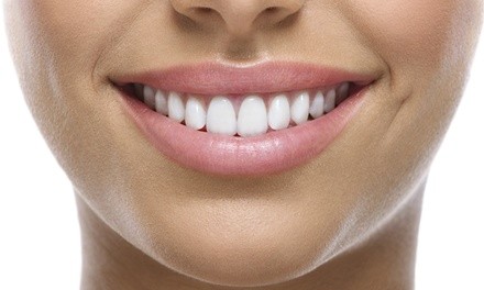One 20-Minute In-Office BleachBright Teeth-Whitening Treatment at Laser Duet (Up to 77% Off). Two Options.