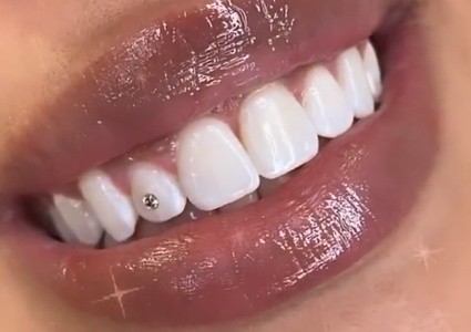 Up to 50% Off on Teeth Whitening - Traditional at Phenix Salon Suites