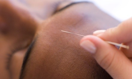 Acupuncture Treatment with Add-Ons at New England Muscular Therapy (Up to 59% Off). Two Options Available.