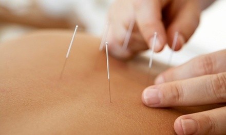 Up to 74% Off on Cupping at TSAO ACUPUNCTURE AND HEALTH CENTER