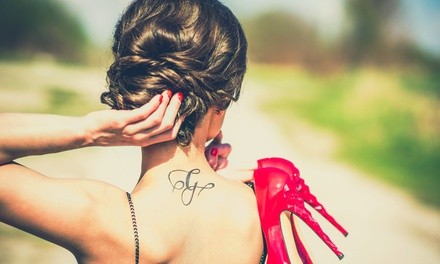 Up to 40% Off on Tattoo Removal at Mountain Island Skin Care