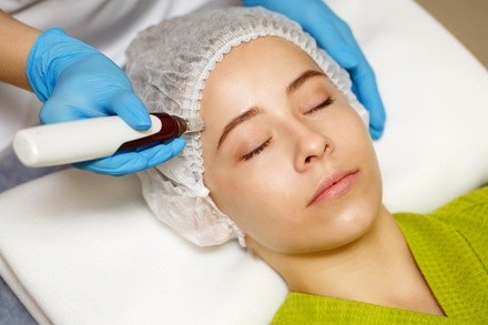 One or Two Radio-Frequency Microneedling and PRP Treatments with Consultation (Up to 68% Off)