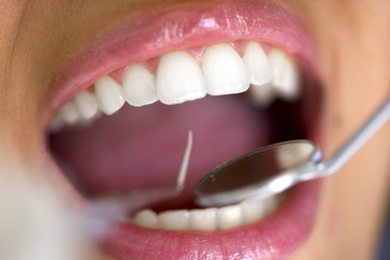 Up to 76% Off on Teeth Cleaning at Dental Emergency Care of Texas