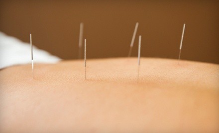 $39 for an Acupuncture Session with Consultation at North Nassau Acupuncture LLC ($85 Value)