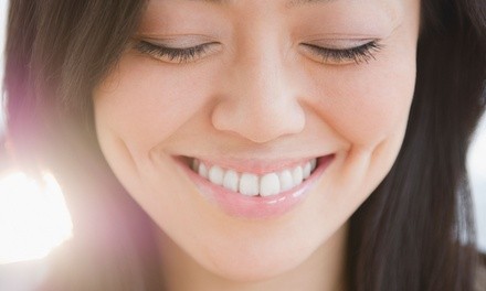 Up to 59% Off on Teeth Whitening - In-Office - Branded (Beyond, Power) at Refresh MD Aesthetics