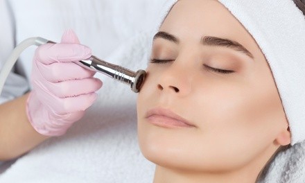 $59 for One Diamond Microdermabrasion Treatment at Merinaz ($110 Value)